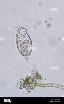 Vorticella! A Tiny Tornado That Swirls Through Freshwater Ecosystems With Graceful Tentacles