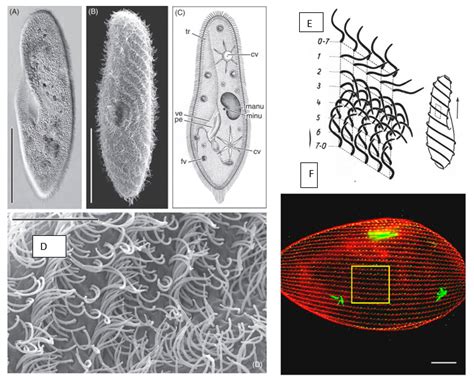  Yurtia: ¡Un Microorganismo Con Cilia Que Te Sorprenderá! Yurtia es un género de protistas flagelados que se encuentran comúnmente en ambientes acuáticos, donde se alimentan principalmente de bacterias y otros microorganismos, desempeñando un papel crucial en la cadena alimentaria.